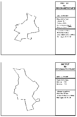 ab3