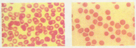 blood